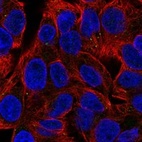 Immunofluorescent staining of human cell line Hep G2 shows localization to vesicles.