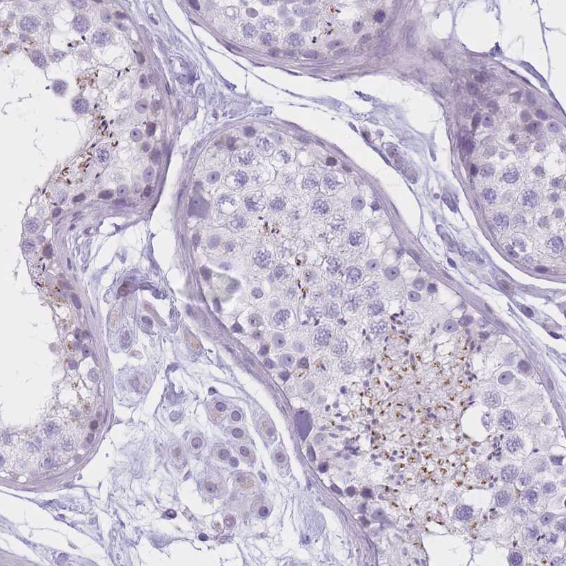 Anti-GOLGA6B Antibody