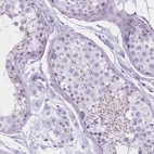 Anti-GOLGA6B Antibody