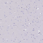Immunohistochemical staining of human cerebral cortex shows no positivity in neurons as expected.
