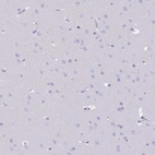 Immunohistochemical staining of human cerebral cortex shows no positivity in neurons as expected.
