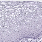 Immunohistochemical staining of human cervix shows no positivity in squamous epithelial cells as expected.