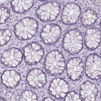 Immunohistochemical staining of human colon shows no positivity in glandular cells as expected.