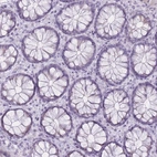 Immunohistochemical staining of human colon shows no positivity in glandular cells as expected.