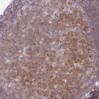 Immunohistochemical staining of human tonsil shows moderate cytoplasmic positivity in germinal center cells.