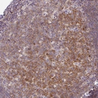 Immunohistochemical staining of human tonsil shows moderate cytoplasmic positivity in germinal center cells.