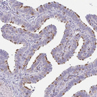 Immunohistochemical staining of human fallopian tube shows moderate positivity in cilia in glandular cells.