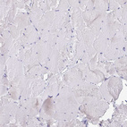 Immunohistochemical staining of human skeletal muscle shows no positivity in myocytes as expected.