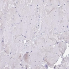 Immunohistochemical staining of human skeletal muscle shows no positivity in myocytes as expected.