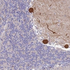 Anti-CYLD Antibody