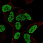 Immunofluorescent staining of human cell line SH-SY5Y shows localization to nucleoplasm.