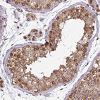 Anti-RANGAP1 Antibody