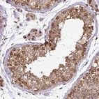 Anti-RANGAP1 Antibody