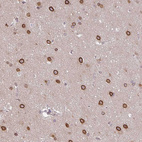 Immunohistochemical staining of human cerebral cortex shows strong nuclear membranous positivity in neurons.