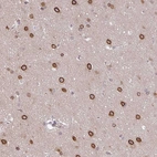 Immunohistochemical staining of human cerebral cortex shows strong nuclear membranous positivity in neurons.