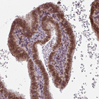 Anti-RANGAP1 Antibody