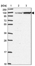 Lane 1: Marker [kDa] 250, 130, 95, 72, 55, 36, 28, 17, 10_br/_Lane 2: Human cell line RT-4_br/_Lane 3: Human cell line U-251 MG