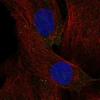 Anti-DYNLT4 Antibody