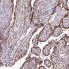 Immunohistochemical staining of human placenta shows moderate cytoplasmic positivity in trophoblastic cells.
