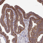 Immunohistochemical staining of human Fallopian tube shows strong cytoplasmic and membranous positivity in glandular cells.