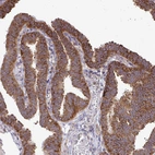 Immunohistochemical staining of human Fallopian tube shows strong cytoplasmic and membranous positivity in glandular cells.
