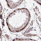 Immunohistochemical staining of human Testis shows strong cytoplasmic positivity in spermatogonia.
