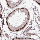 Immunohistochemical staining of human Testis shows strong cytoplasmic positivity in spermatogonia.
