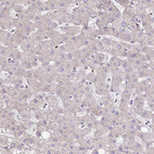 Immunohistochemical staining of human Liver shows weak cytoplasmic positivity in hepatocytes.