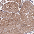 Anti-BST1 Antibody