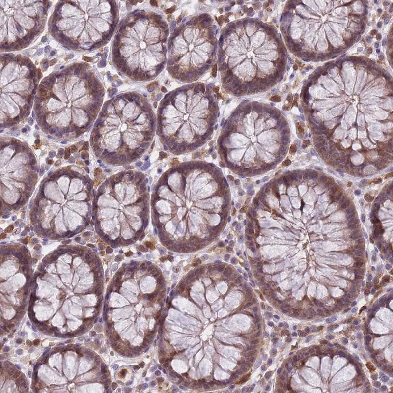 Anti-CXorf38 Antibody