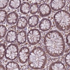 Anti-CXorf38 Antibody