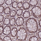 Anti-CXorf38 Antibody