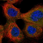Immunofluorescent staining of human cell line A-431 shows localization to cytosol.