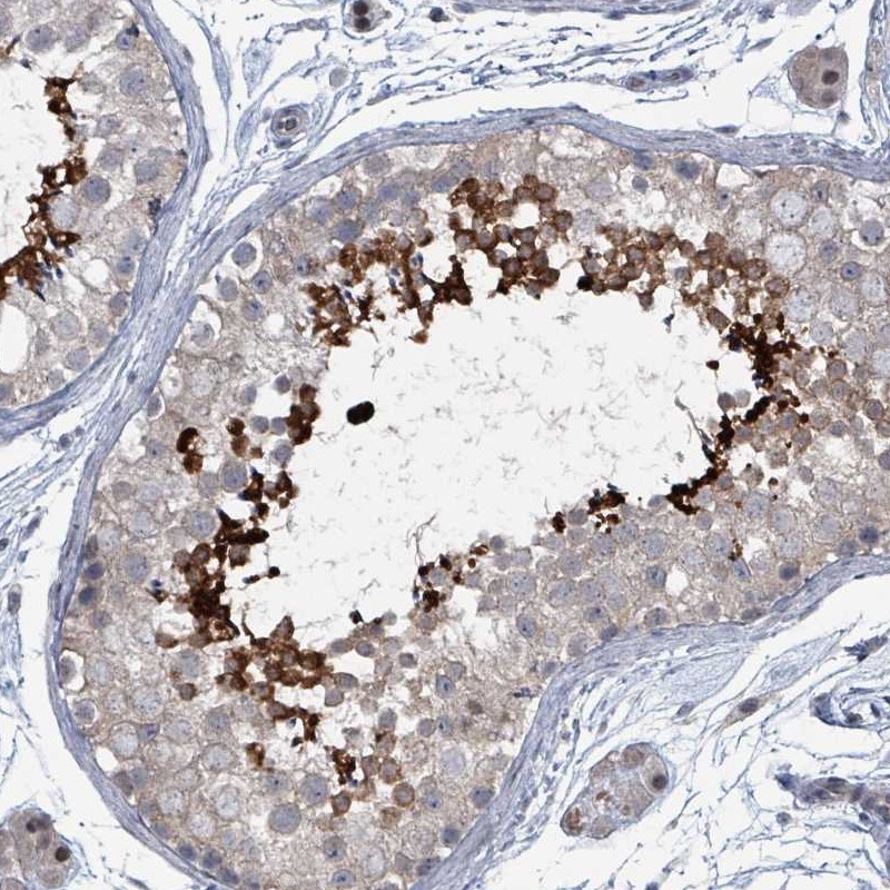Anti-BIVM Antibody
