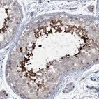 Anti-BIVM Antibody