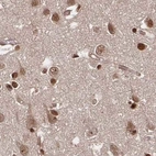 Immunohistochemical staining of human cerebral cortex using Anti-GLYR1 antibody HPA050136.