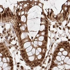 Immunohistochemical staining of human colon using Anti-GLYR1 antibody HPA050136.
