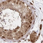 Immunohistochemical staining of human testis using Anti-GLYR1 antibody HPA050136.