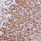 Anti-FAM58A Antibody