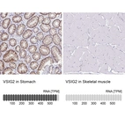 Anti-VSIG2 Antibody