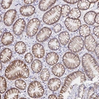 Immunohistochemical staining of human stomach shows strong cytoplasmic positivity in glandular cells.