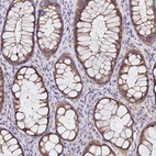 Immunohistochemical staining of human rectum shows strong cytoplasmic positivity in glandular cells.