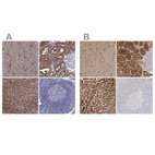 Immunohistochemical staining of human cerebral cortex, kidney, liver and lymph node using Anti-ALDH1L1 antibody HPA050139 (A) shows similar protein distribution across tissues to independent antibody HPA036900 (B).