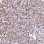 Anti-VSIG2 Antibody