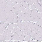 Immunohistochemical staining of human skeletal muscle shows no positivity in myocytes as expected.