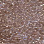 Immunohistochemical staining of human liver shows strong cytoplasmic positivity in hepatocytes.
