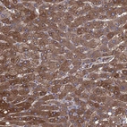 Immunohistochemical staining of human liver shows strong cytoplasmic positivity in hepatocytes.