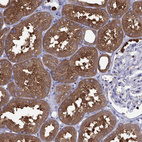 Immunohistochemical staining of human kidney shows strong cytoplasmic positivity in cells in tubules.