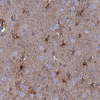 Immunohistochemical staining of human cerebral cortex shows strong cytoplasmic positivity in astrocytes.