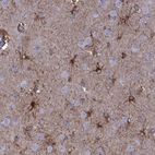 Immunohistochemical staining of human cerebral cortex shows strong cytoplasmic positivity in astrocytes.